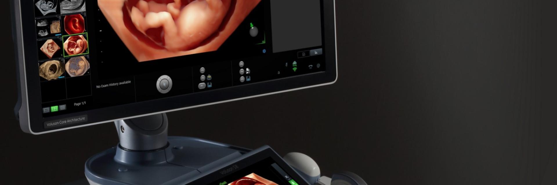 Voluson_S8_touch_big